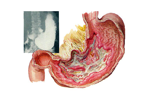 “开云电竞官方网站”第1307章 这是两个鸡蛋黄吗(图3) 开云电竞中国